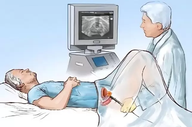 diagnosticul de prostatita